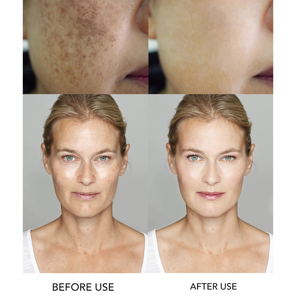 AILKE Whitening Moisturizing Facial Cream for Dark Spots