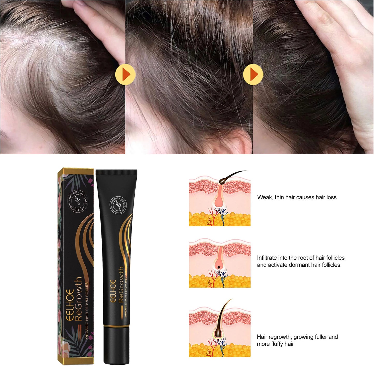 Eelhoe Regrowth Hair Serum With Roller Massage Scalp