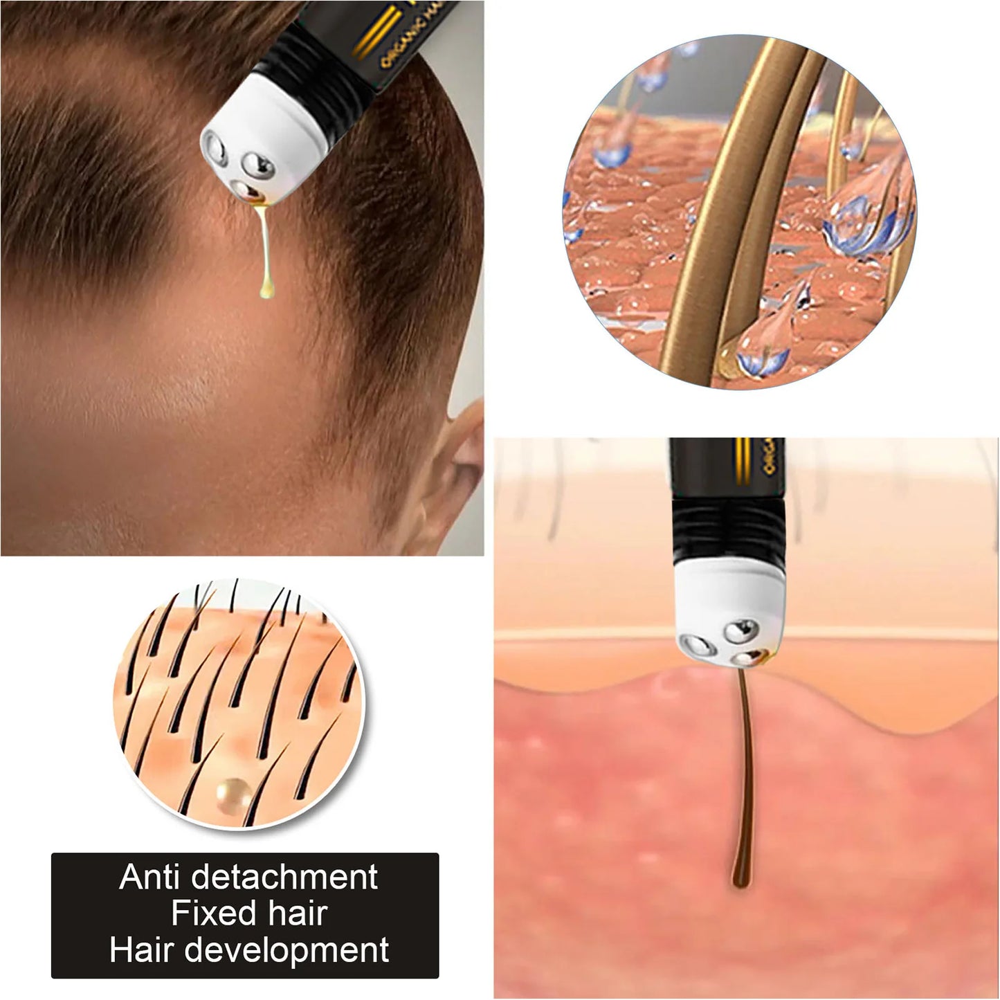 Eelhoe Regrowth Hair Serum With Roller Massage Scalp