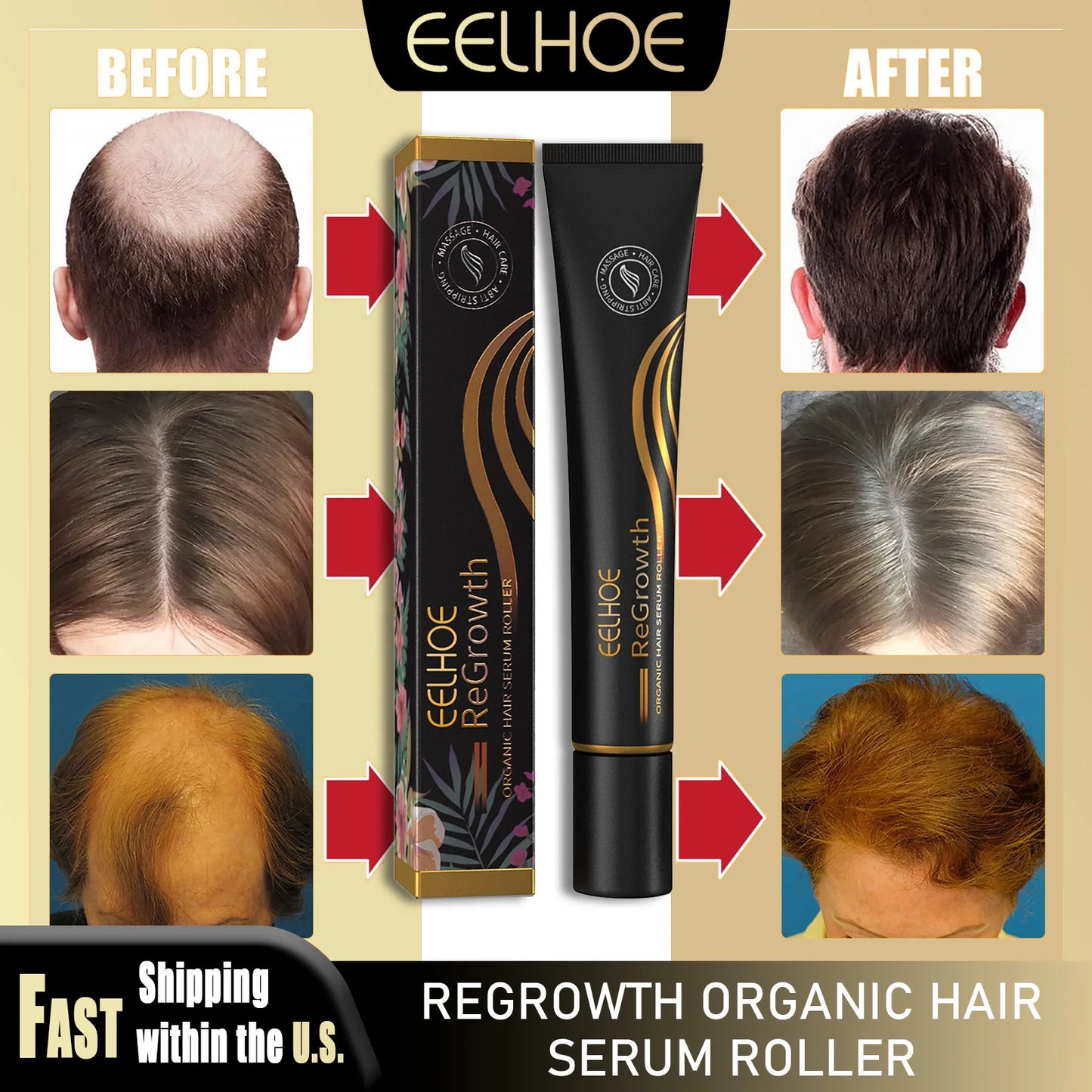 Eelhoe Regrowth Hair Serum With Roller Massage Scalp