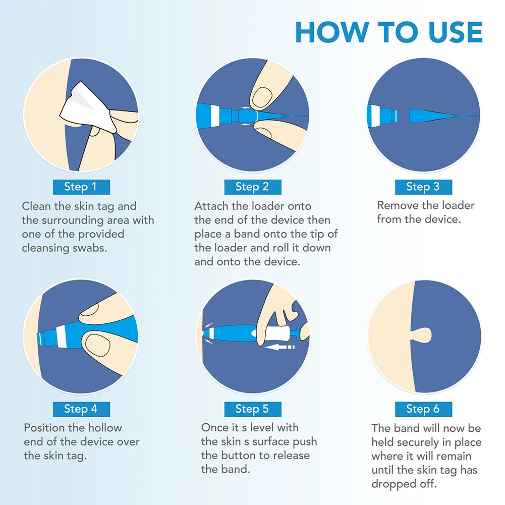 Rubber Ring Face Mole Removal Tool Kit For Safe Painless Wart Removal