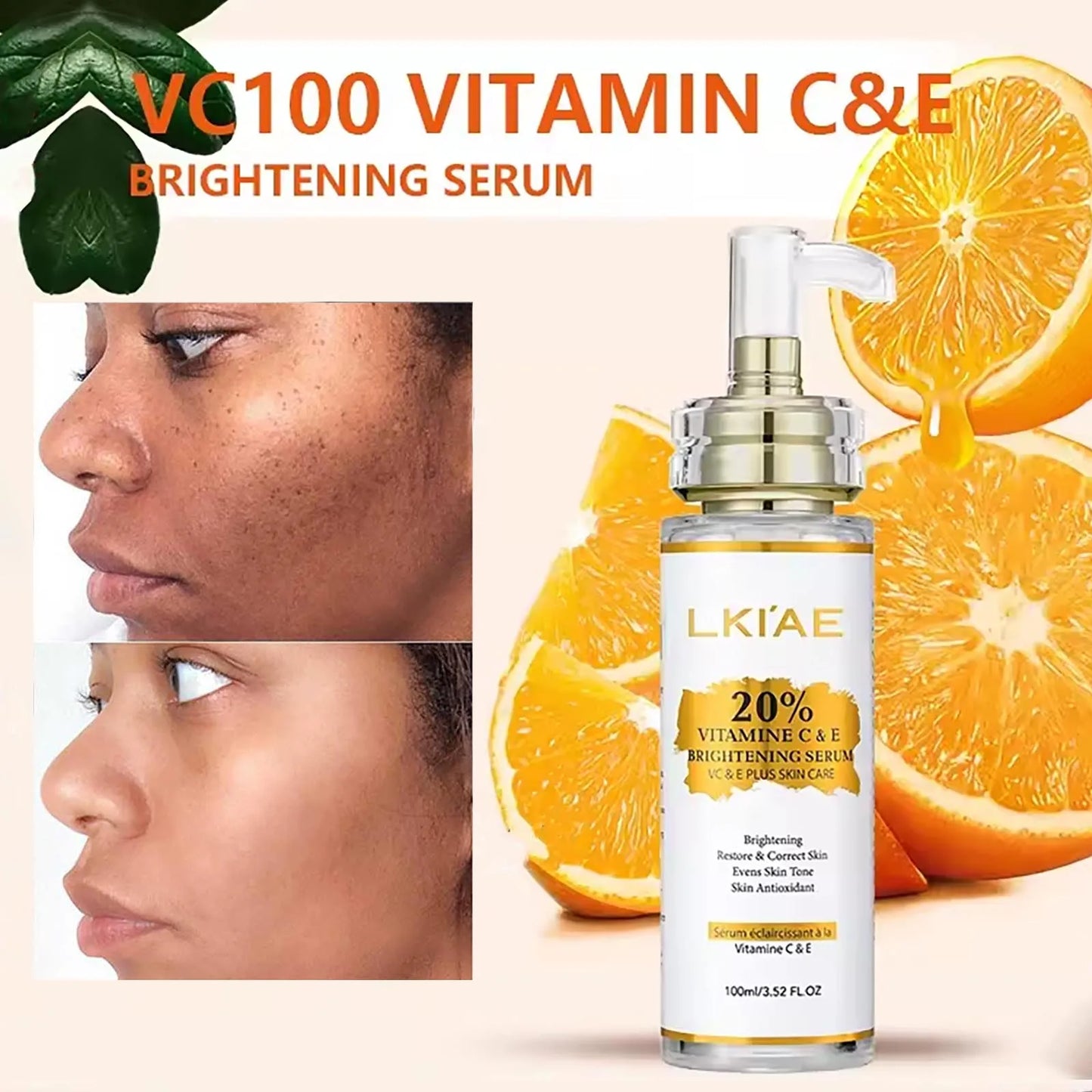 AILKE Vitamin C Skin Care Set Brightening Soap And Serum