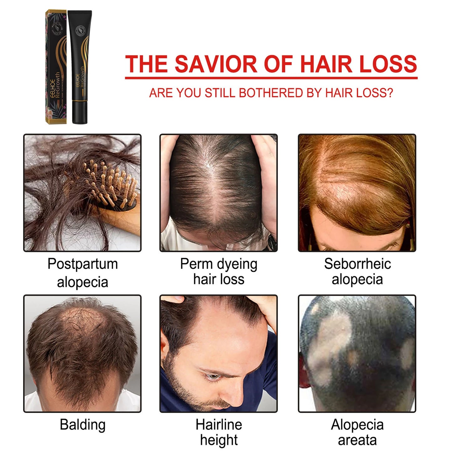 Eelhoe Regrowth Hair Serum With Roller Massage Scalp