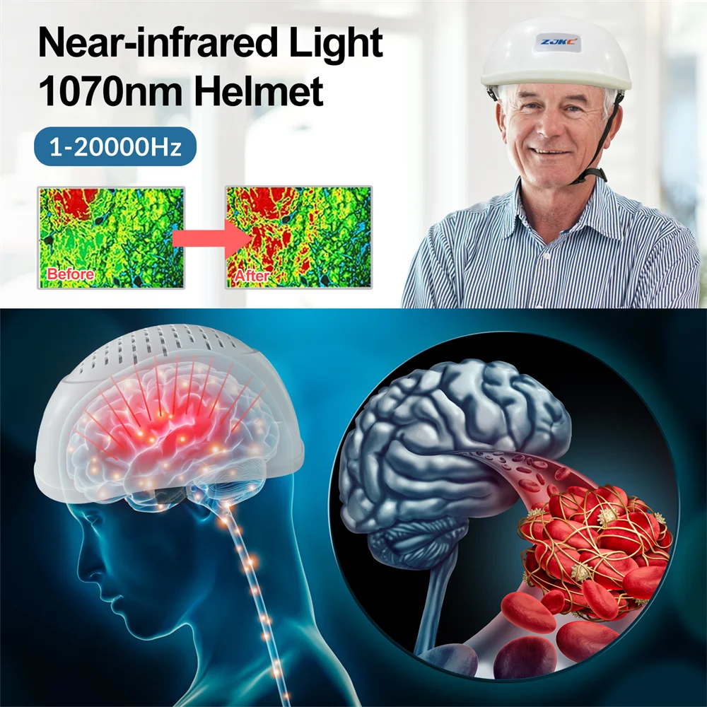 ZJKC Infrared Brain Therapy Helmet For Dementia And Cognition